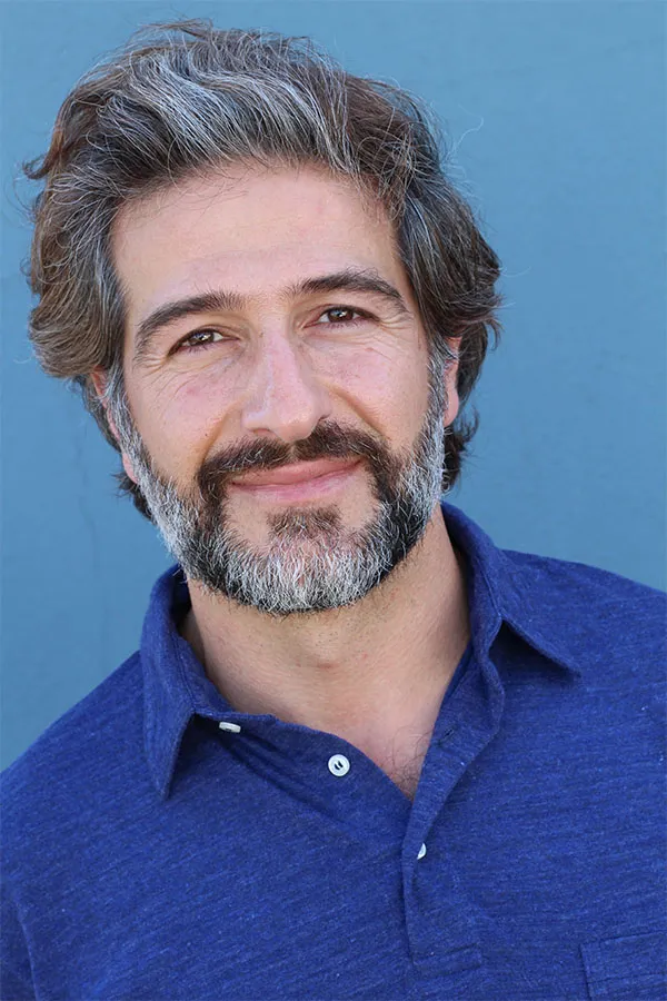 Rosacea-Treatment A women framing her face with her hands while inspecting her Rosacea. Receive IPL and Laser Treatment for Rosacea by Tanya Zboril, NP of TBT Medical in Kitchener-Waterloo.