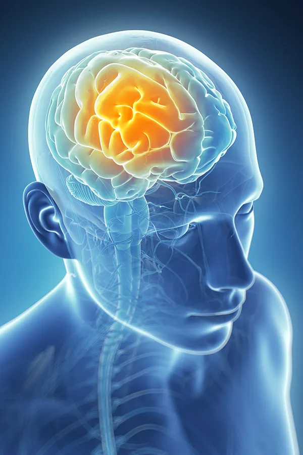 Migraine-Treatment 3D illustration of the brain with glowing pain center. Tanya Zboril, NP of TBT Medical treats migraines using functional medicine in Kitchener-Waterloo.